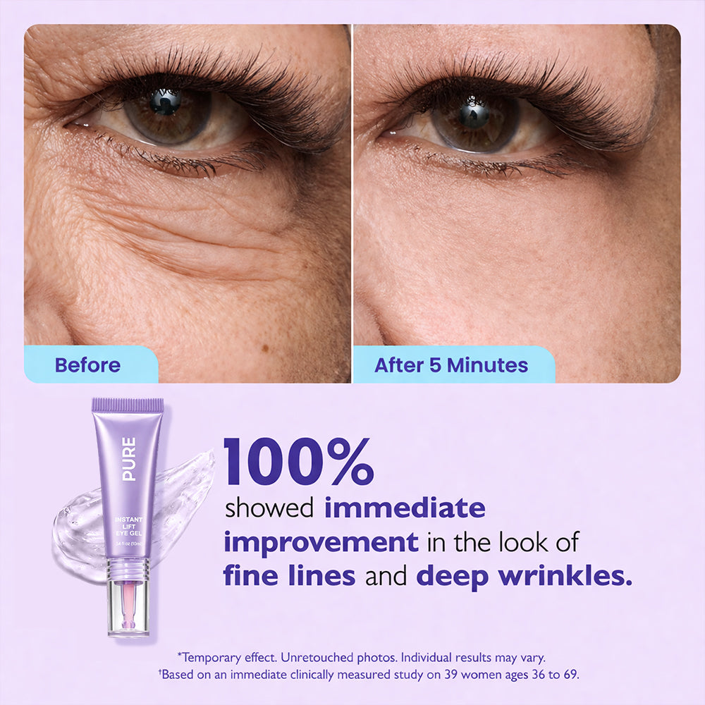 🔥Final 2 Hour 70% OFF🔥Instant Lift Eye Gel - Erase Eye Bags in Minutes