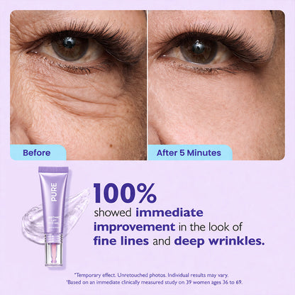 🔥Final 2 Hour 70% OFF🔥Instant Lift Eye Gel - Erase Eye Bags in Minutes