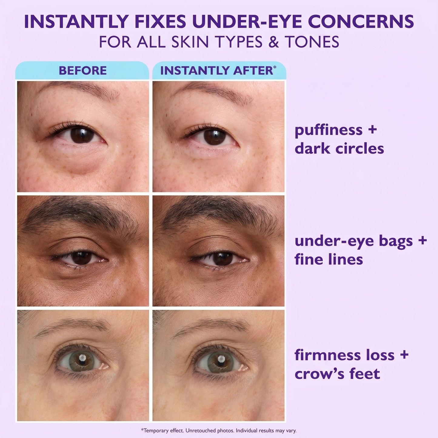 🔥Final 2 Hour 70% OFF🔥Instant Lift Eye Gel - Erase Eye Bags in Minutes