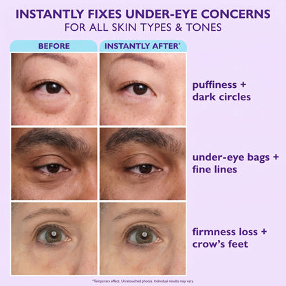🔥Final 2 Hour 70% OFF🔥Instant Lift Eye Gel - Erase Eye Bags in Minutes